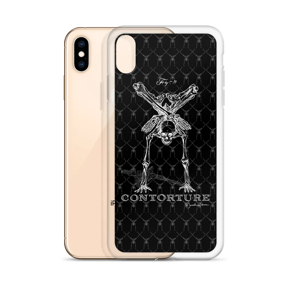 Contorture iPhone Case: Boney White Contortion Skeleton